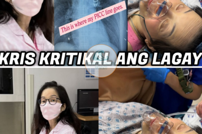 Lima sa Siyam Na Autoimmune Diseases Ni Kris Aquino Maaring Maging Dahilan Sa Kanyang Tuluyang Pamamaalam