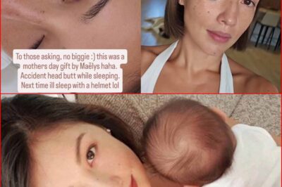 Ang Nakakakilabot na Black Eye Bruise ni Solenn Heussaff: Hindi inaasahang Headbutt!