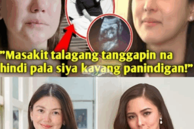 Angelica Panganiban Breaks Her Silence: The “Secret” Behind Kim Chiu and Xian Lim’s Breakup Revealed