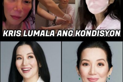 🔥Kris Aquino may sad news tungkol sa kanyang karamdaman ngayon na patuloy na lumalala