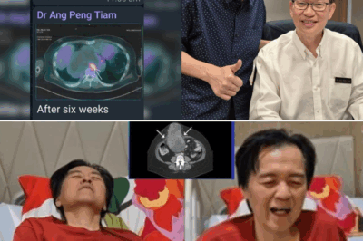 Ito Pala ang Dahilan Kaya Nagkaroon ng Cancer si Doc Willie Ong!
